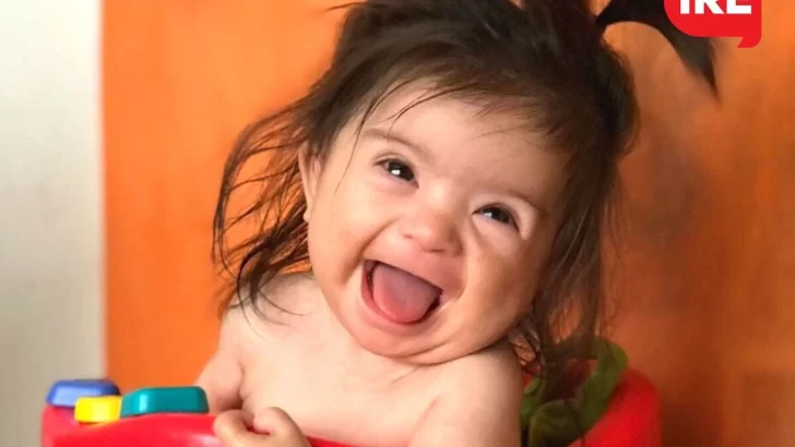 Alma tiene 8 meses y es la musa de Incluite para “conocer sobre discapacidad”