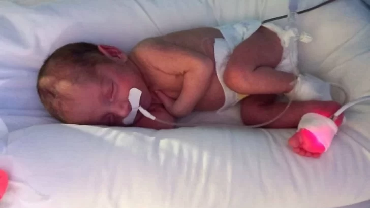 Olivia nació prematura, Iapos no le cubre más la neo y su familia pide ayuda