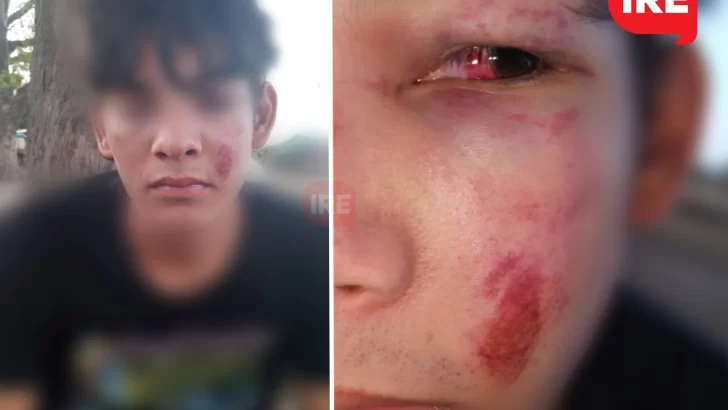 Golpearon a un adolescente en patota en Timbúes: “Queremos justicia”
