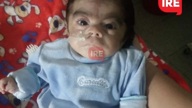 Seba tiene 4 meses, nació prematuro y necesita la ayuda de la región para volver a Gaboto