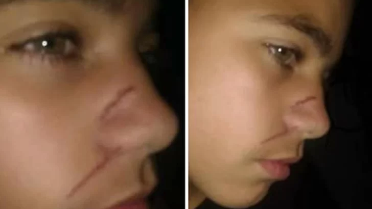 Sufrió una lesión en la cara tras ser agredido por una compañera