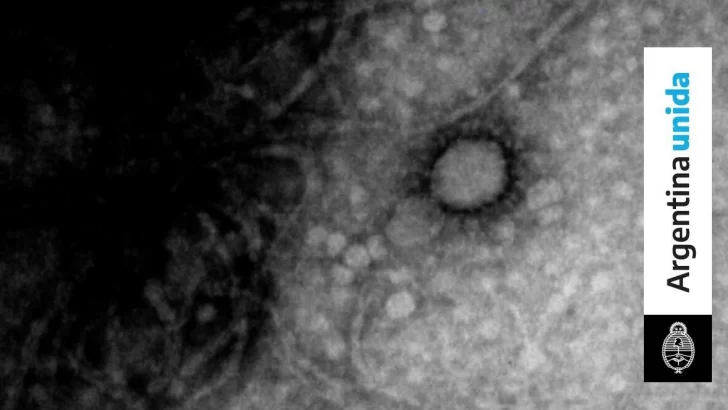 Lograron la primera foto del nuevo coronavirus en Argentina