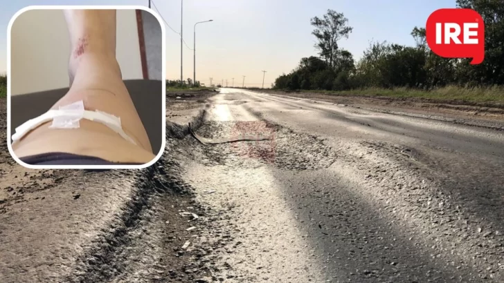 Villa La Ribera: Una joven se cayó de la moto por un bache en ruta 91