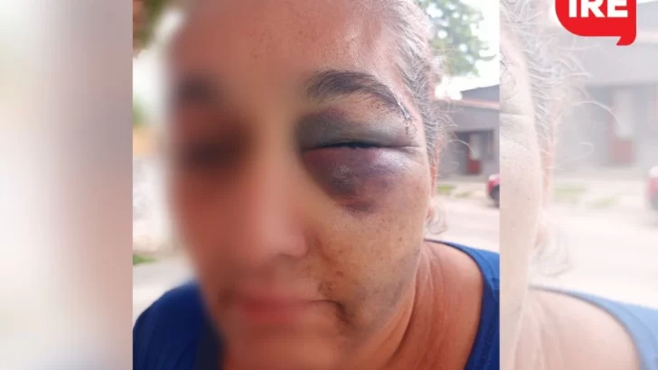 Violencia extrema: Encontró a su ex en la calle, la golpeó y le quebró el pómulo y maxilar