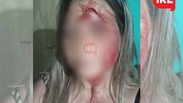Una mujer de Díaz atacó a otra con un fierro: “Casi me mata delante de mis hijos”