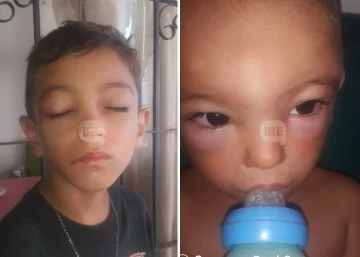 Una familia con dos niños de 2 y 7 años fueron atacados por abejas en Maciel