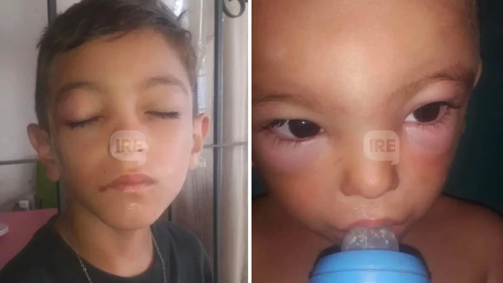 Una familia con dos niños de 2 y 7 años fueron atacados por abejas en Maciel