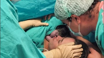 El Garrahan marca un hito en la medicina pública: Primera cirugía fetal realizada en Argentina