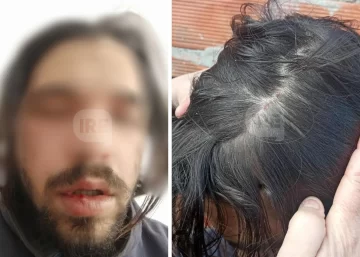 Su perra se metió en la casa de la vecina, quiso disculparse pero terminó golpeado