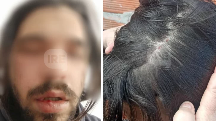 Su perra se metió en la casa de la vecina, quiso disculparse pero terminó golpeado