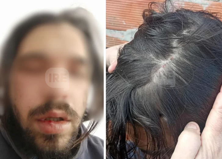 Su perra se metió en la casa de la vecina, quiso disculparse pero terminó golpeado
