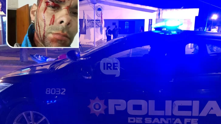 Violento robo a mano armada en Gaboto: La víctima sufrió otro hecho delictivo hace 20 días