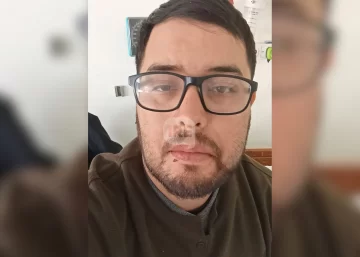 Brutal golpiza a un muchacho de Puerto en Timbúes: Tiene fracturada la mandíbula y deberán operarlo