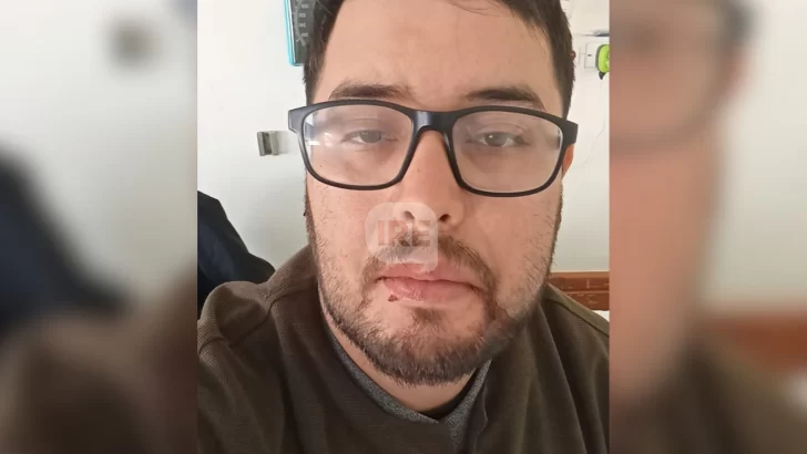Brutal golpiza a un muchacho de Puerto en Timbúes: Tiene fracturada la mandíbula y deberán operarlo