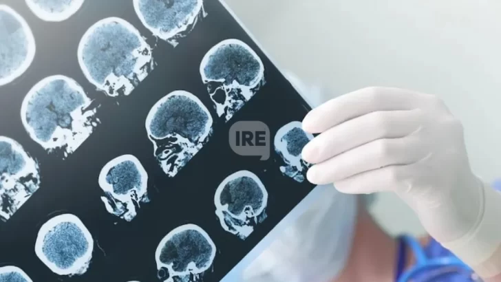 Cada vez más menores de 55 años sufren un ACV: Advierten por el impacto del estrés y el sedentarismo