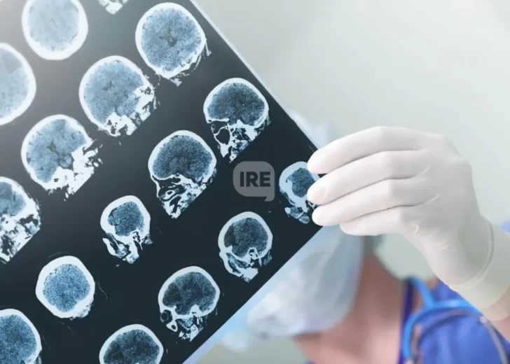 Cada vez más menores de 55 años sufren un ACV: Advierten por el impacto del estrés y el sedentarismo Cada vez más menores de 55 años sufren un ACV: Advierten por el impacto del estrés y el sedentarismo