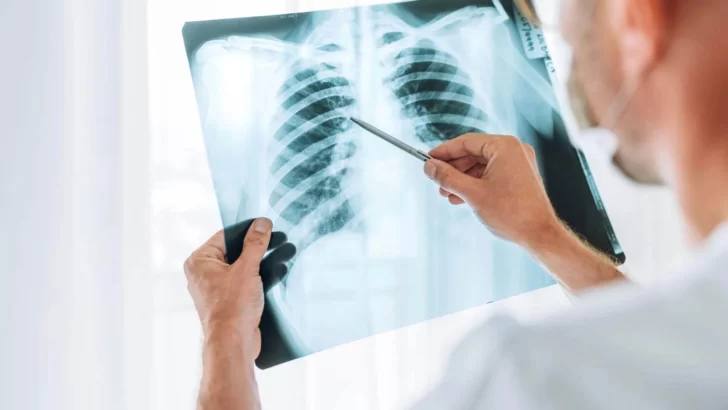 Día Mundial contra la Neumonía: Una enfermedad prevenible que aún causa millones de muertes