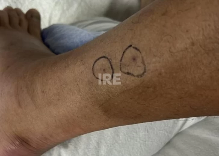 Peligro en el río: Una yarará mordió a un turista en las islas frente a Puerto Aragón Peligro en el río: Una yarará mordió a un turista en las islas frente a Puerto Aragón