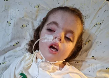 “Fue una emoción enorme, no lo podía creer”: Tras el pedido de ayuda, Maria Emilia recibirá las cánulas que necesita “Fue una emoción enorme, no lo podía creer”: Tras el pedido de ayuda, Maria Emilia recibirá las cánulas que necesita