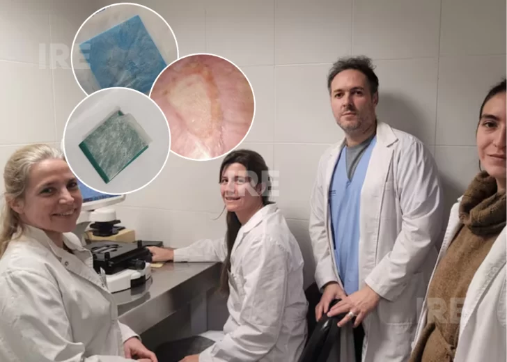 Histórico avance argentino: Científicos lograron cicatrizar una herida compleja con tejido de placenta Histórico avance argentino: Científicos lograron cicatrizar una herida compleja con tejido de placenta